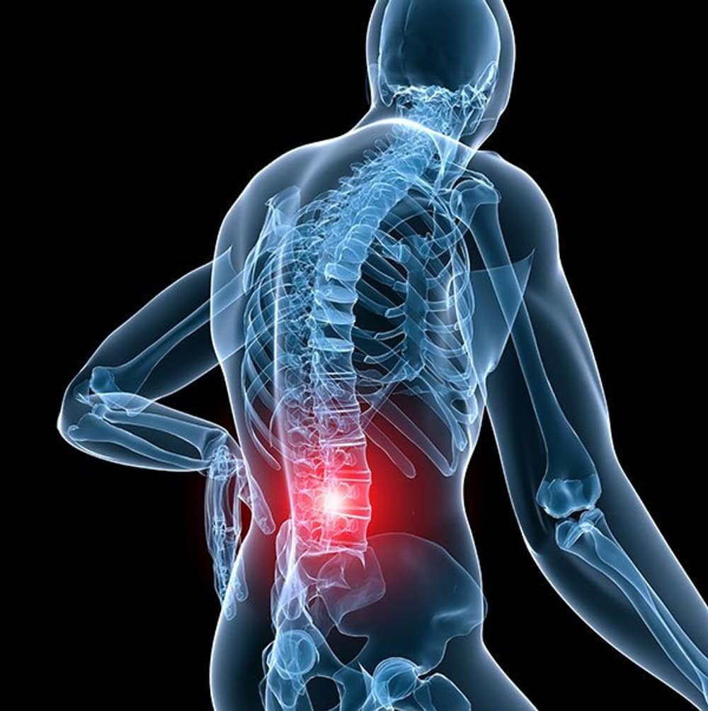 back-pain Cellular therapy for chronic pain